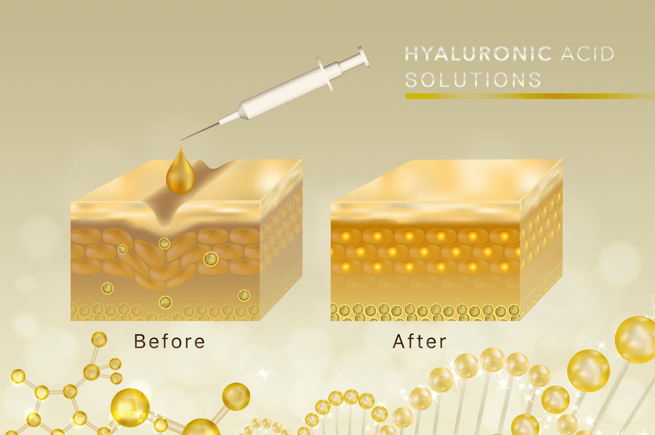 Illustration of the effect of hyaluronic acid