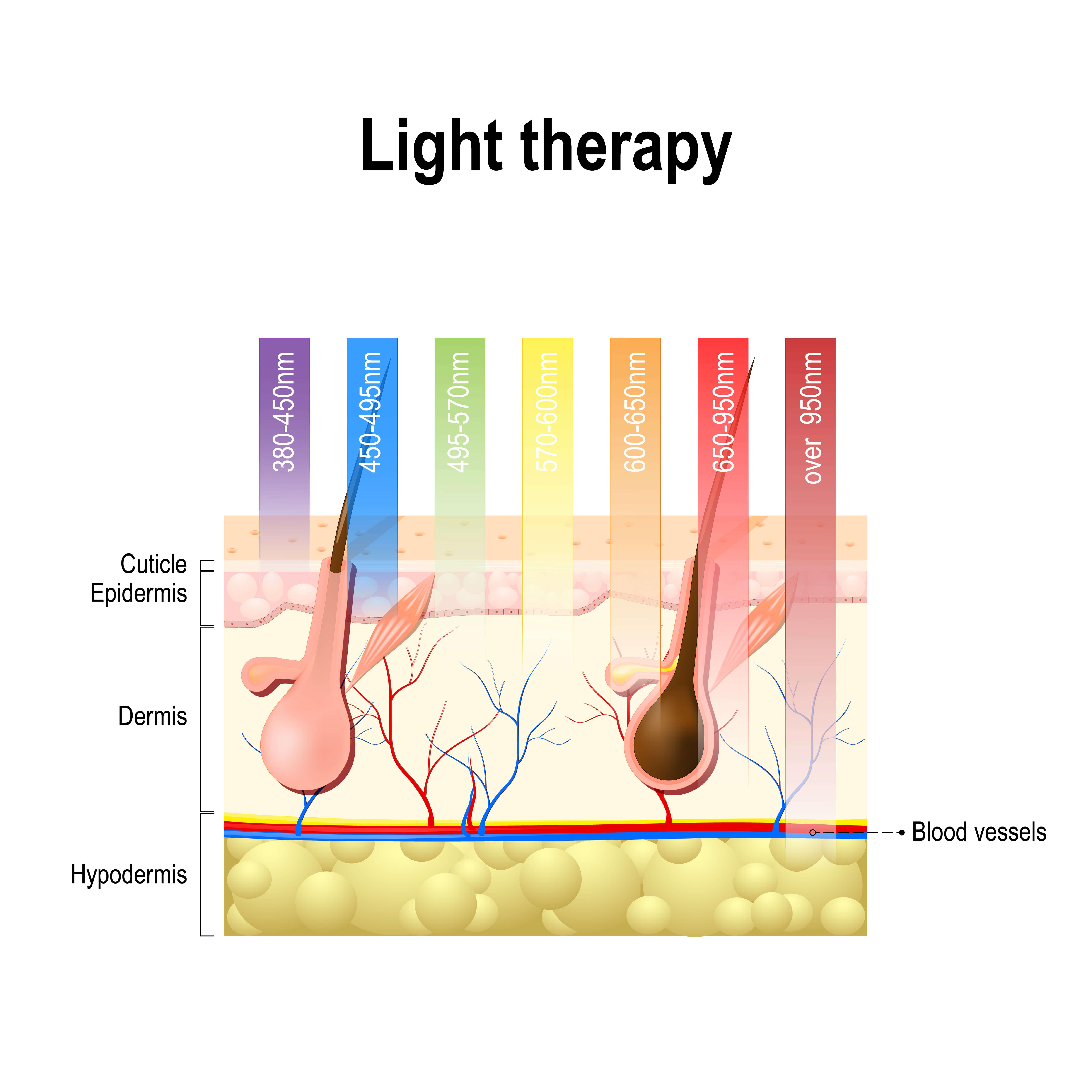 Infographic on light therapy 