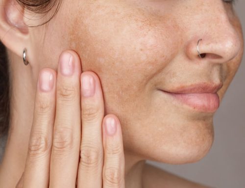 Dark Spots and Hyperpigmentation: What’s Trending in 2025